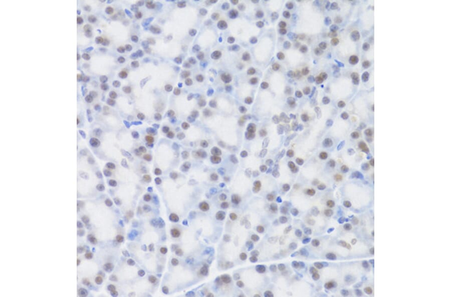 Immunohistochemistry - Anti-MCM4 Antibody (A14305) - Antibodies.com