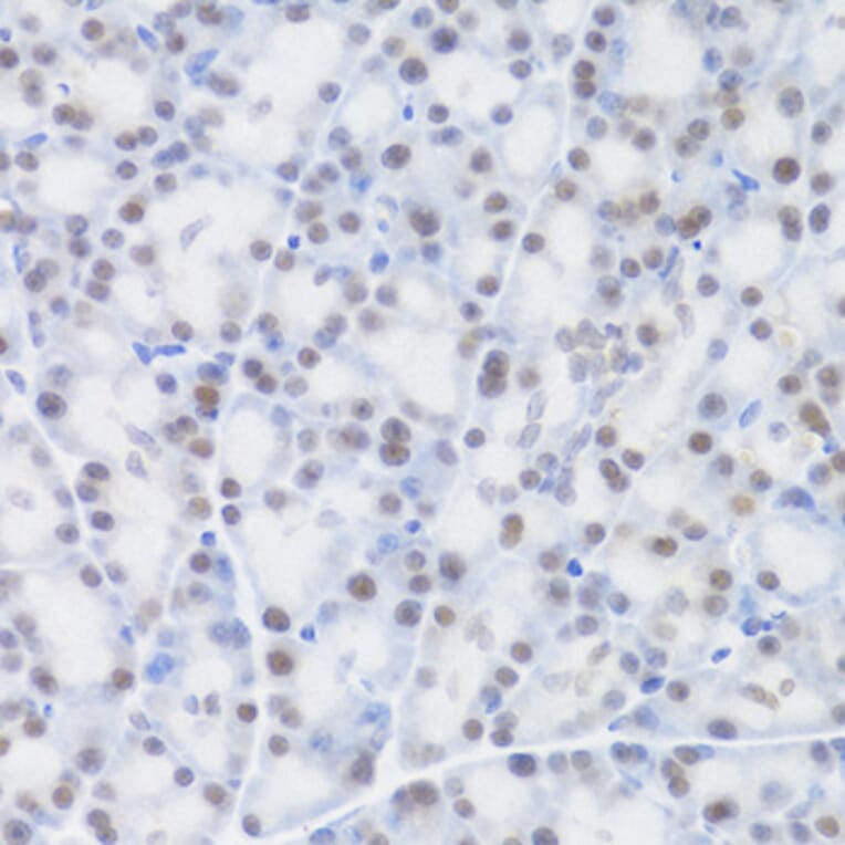 Immunohistochemistry - Anti-MCM4 Antibody (A14305) - Antibodies.com
