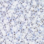 Immunohistochemistry - Anti-MCM4 Antibody (A14305) - Antibodies.com