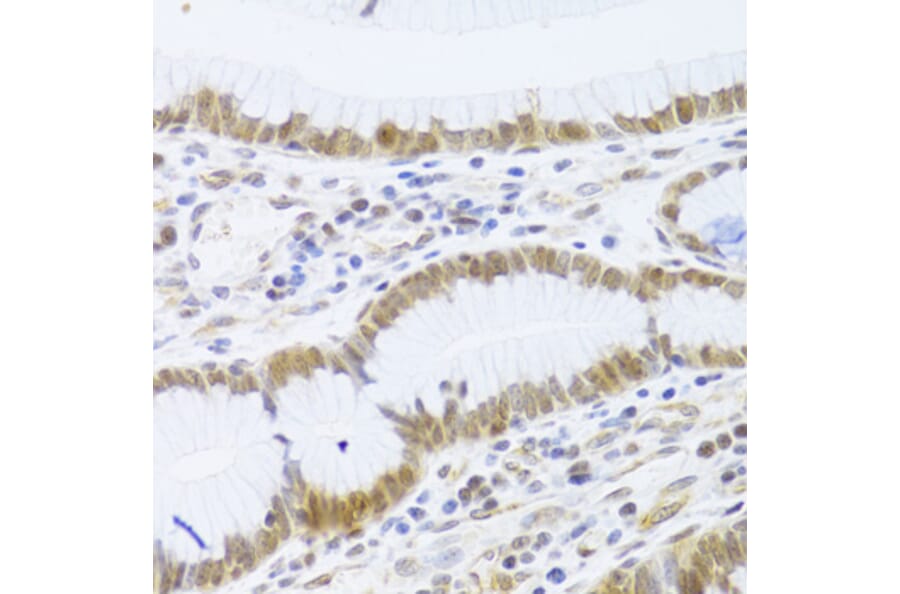 Immunohistochemistry - Anti-MCM4 Antibody (A14305) - Antibodies.com