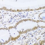 Immunohistochemistry - Anti-MCM4 Antibody (A14305) - Antibodies.com
