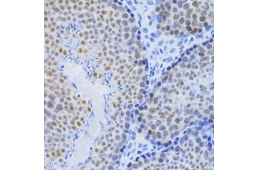 Immunohistochemistry - Anti-MCM4 Antibody (A14305) - Antibodies.com