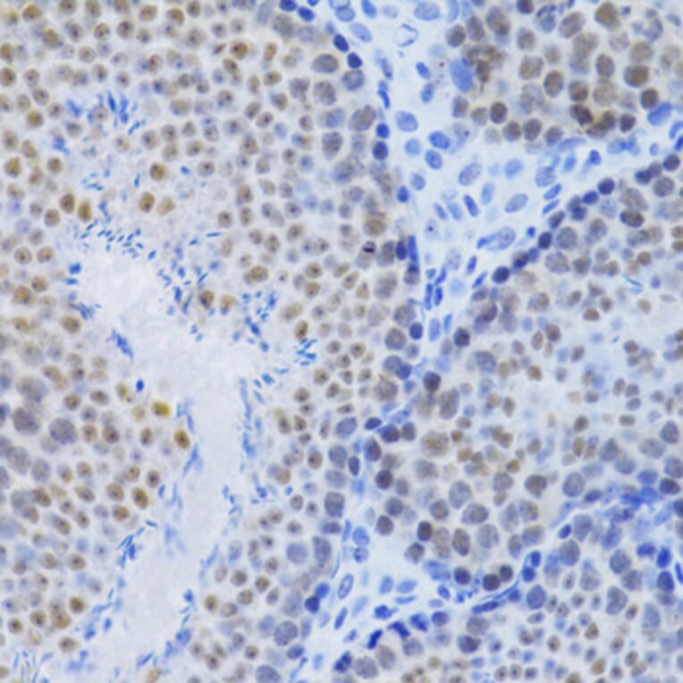 Immunohistochemistry - Anti-MCM4 Antibody (A14305) - Antibodies.com