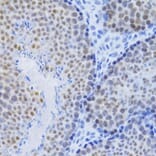 Immunohistochemistry - Anti-MCM4 Antibody (A14305) - Antibodies.com