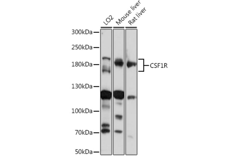 Western Blot - Anti-CSF-1-R Antibody (A14306) - Antibodies.com