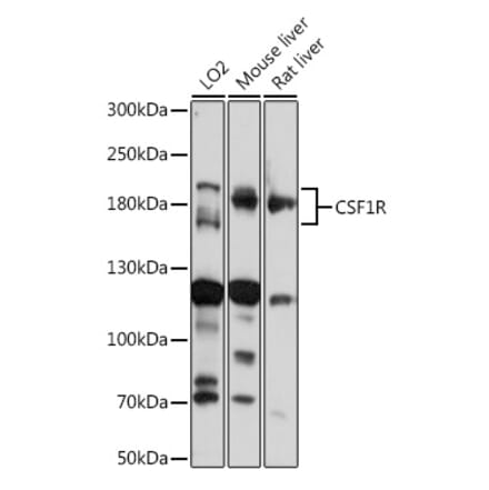 Western Blot - Anti-CSF-1-R Antibody (A14306) - Antibodies.com