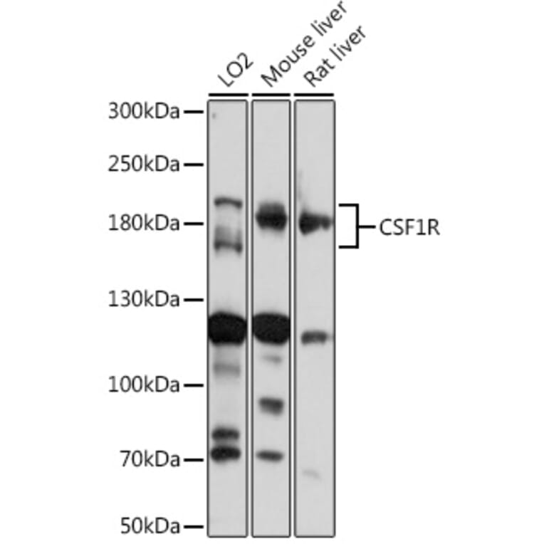 Western Blot - Anti-CSF-1-R Antibody (A14306) - Antibodies.com