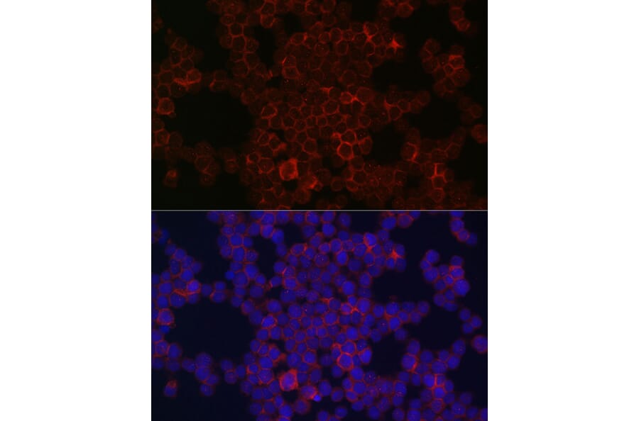 Immunofluorescence - Anti-CSF-1-R Antibody (A14306) - Antibodies.com