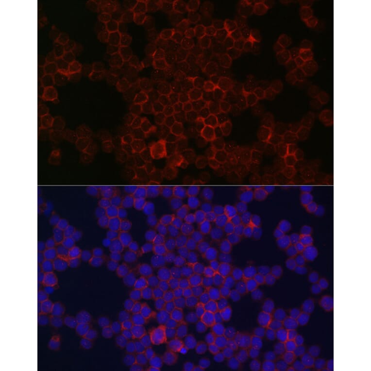 Immunofluorescence - Anti-CSF-1-R Antibody (A14306) - Antibodies.com