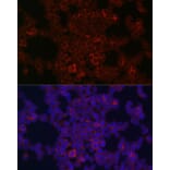 Immunofluorescence - Anti-CSF-1-R Antibody (A14306) - Antibodies.com