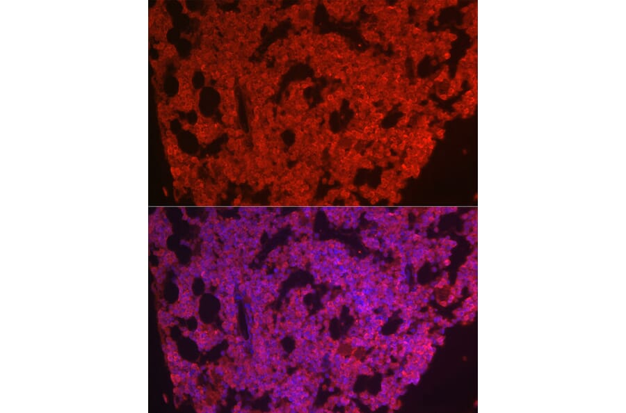 Immunofluorescence - Anti-CSF-1-R Antibody (A14306) - Antibodies.com