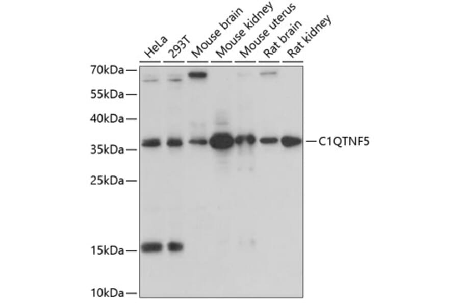 Western Blot - Anti-CTRP5 Antibody (A14307) - Antibodies.com