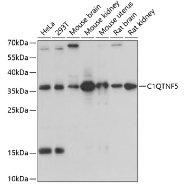 Western Blot - Anti-CTRP5 Antibody (A14307) - Antibodies.com