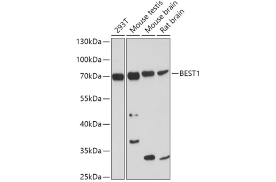 Western Blot - Anti-Bestrophin/BEST1 Antibody (A14308) - Antibodies.com