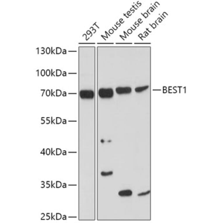 Western Blot - Anti-Bestrophin/BEST1 Antibody (A14308) - Antibodies.com