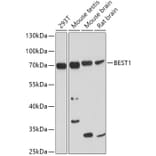 Western Blot - Anti-Bestrophin/BEST1 Antibody (A14308) - Antibodies.com