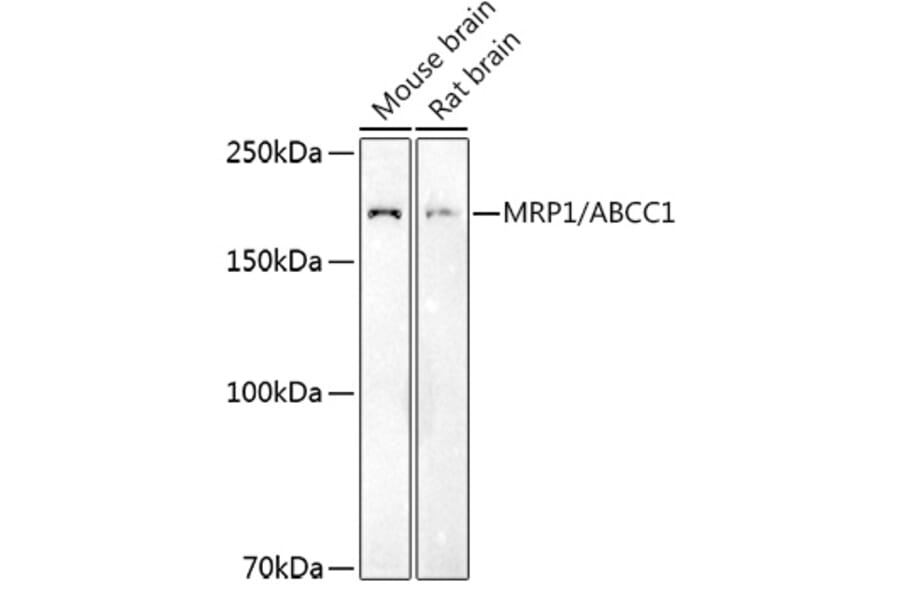 Western Blot - Anti-MRP1 Antibody (A14309) - Antibodies.com