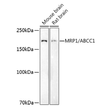 Western Blot - Anti-MRP1 Antibody (A14309) - Antibodies.com