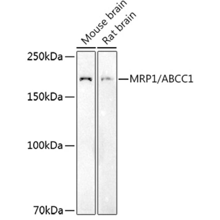 Western Blot - Anti-MRP1 Antibody (A14309) - Antibodies.com