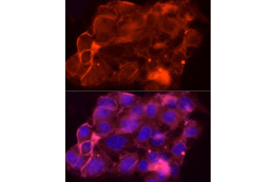 Immunofluorescence - Anti-MRP1 Antibody (A14309) - Antibodies.com