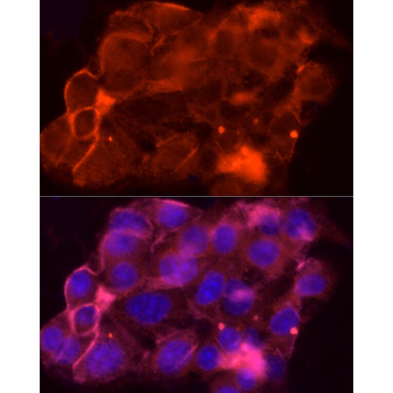 Immunofluorescence - Anti-MRP1 Antibody (A14309) - Antibodies.com