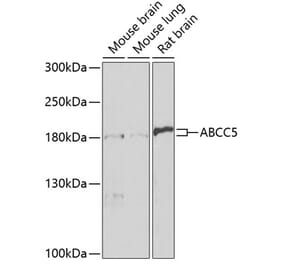 Western Blot - Anti-MRP5 Antibody (A14310) - Antibodies.com