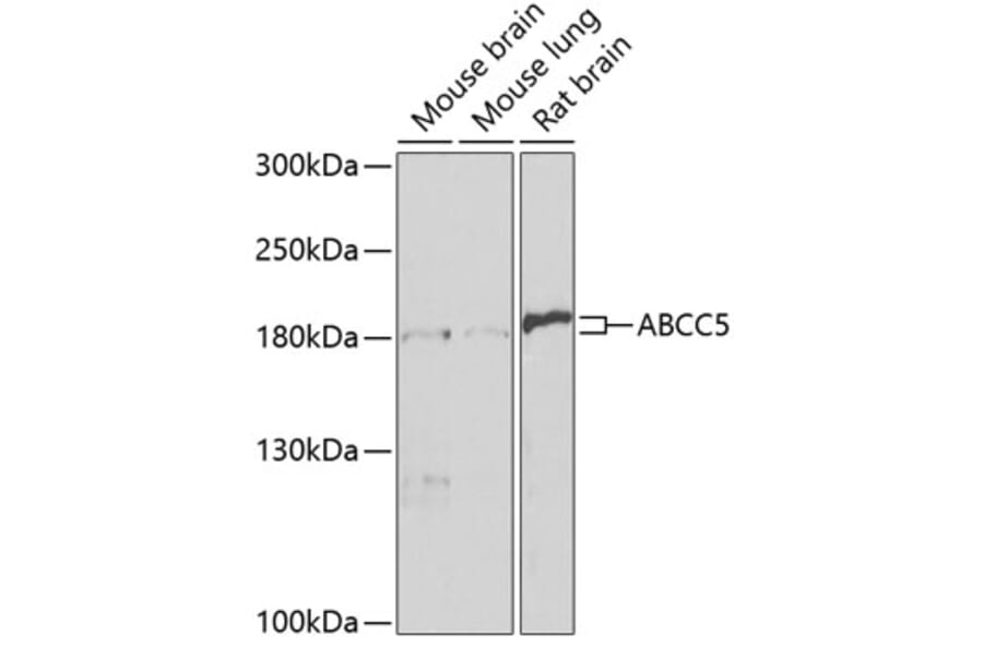 Western Blot - Anti-MRP5 Antibody (A14310) - Antibodies.com