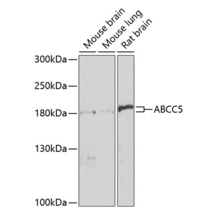 Western Blot - Anti-MRP5 Antibody (A14310) - Antibodies.com