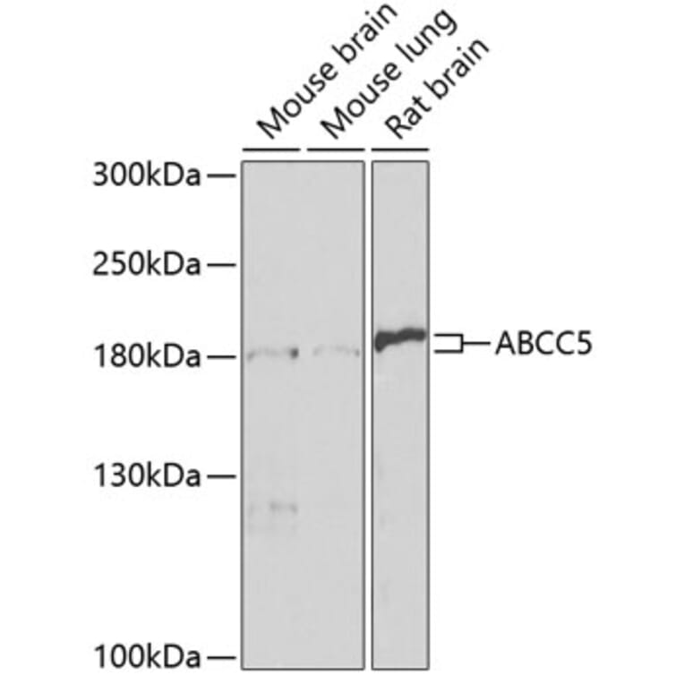 Western Blot - Anti-MRP5 Antibody (A14310) - Antibodies.com