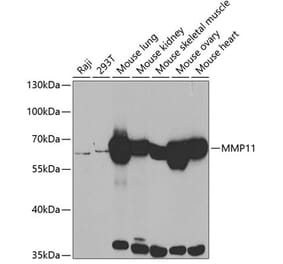 Western Blot - Anti-MMP11 Antibody (A14312) - Antibodies.com