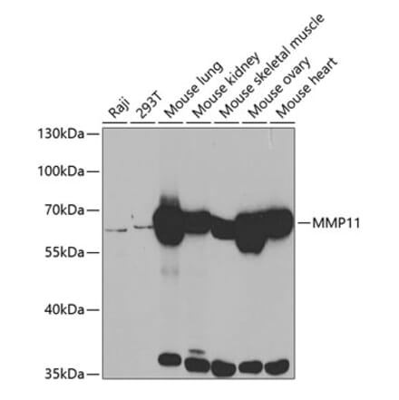Western Blot - Anti-MMP11 Antibody (A14312) - Antibodies.com