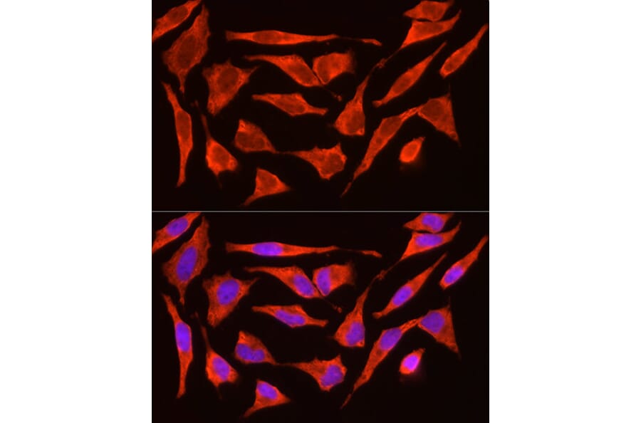 Immunofluorescence - Anti-ACTH Antibody (A14313) - Antibodies.com