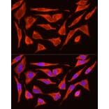 Immunofluorescence - Anti-ACTH Antibody (A14313) - Antibodies.com