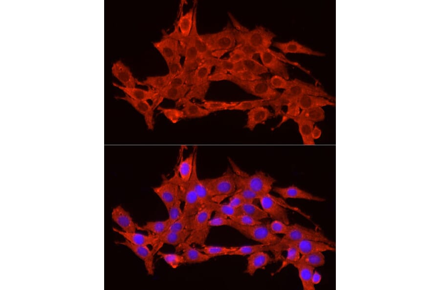 Immunofluorescence - Anti-ACTH Antibody (A14313) - Antibodies.com