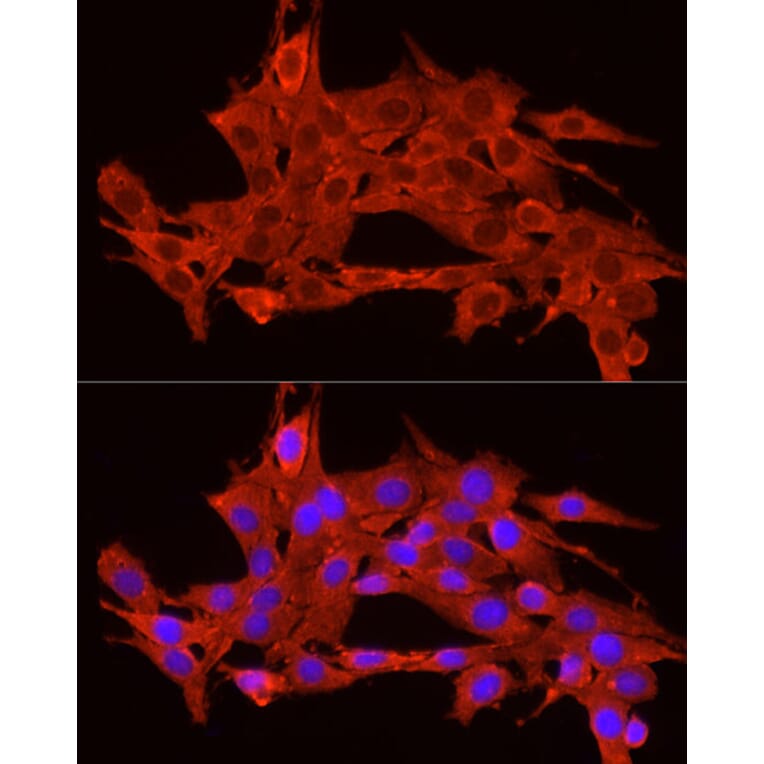 Immunofluorescence - Anti-ACTH Antibody (A14313) - Antibodies.com