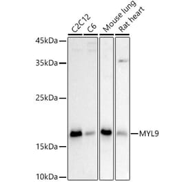 Western Blot - Anti-MYL9 Antibody (A14314) - Antibodies.com