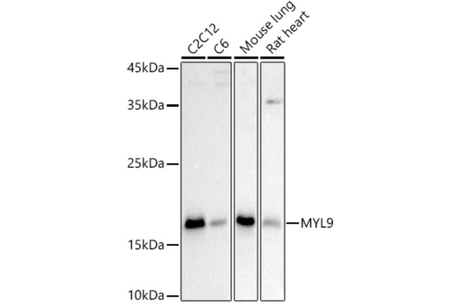 Western Blot - Anti-MYL9 Antibody (A14314) - Antibodies.com