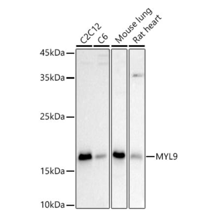 Western Blot - Anti-MYL9 Antibody (A14314) - Antibodies.com