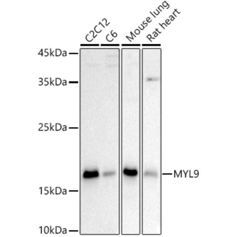 Western Blot - Anti-MYL9 Antibody (A14314) - Antibodies.com