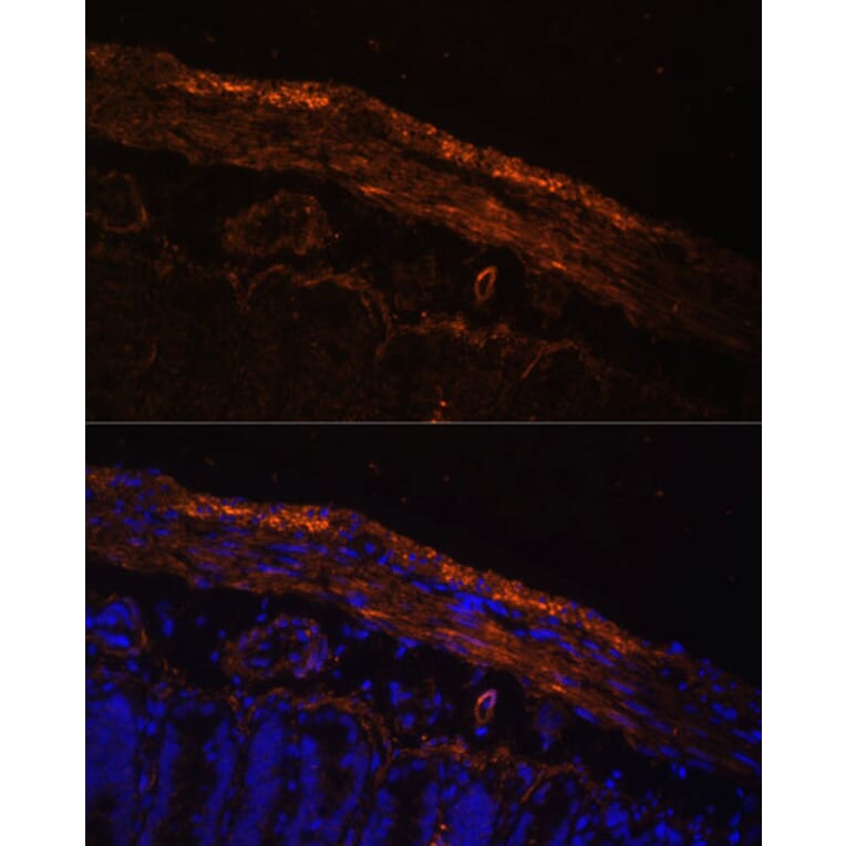 Immunofluorescence - Anti-MYL9 Antibody (A14314) - Antibodies.com