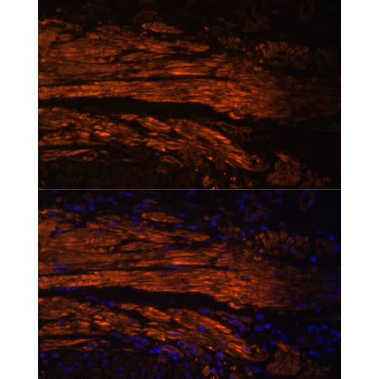 Immunofluorescence - Anti-MYL9 Antibody (A14314) - Antibodies.com