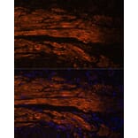 Immunofluorescence - Anti-MYL9 Antibody (A14314) - Antibodies.com