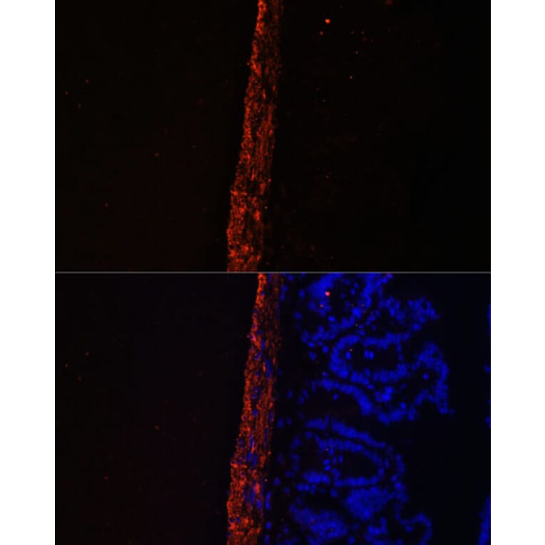 Immunofluorescence - Anti-MYL9 Antibody (A14314) - Antibodies.com