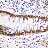 Immunohistochemistry - Anti-14-3-3 gamma / YWHAG Antibody (A14317) - Antibodies.com