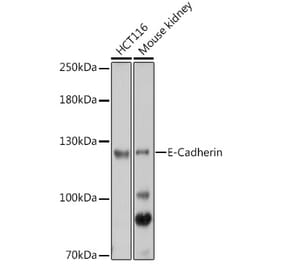 Western Blot - Anti-E Cadherin Antibody (A14318) - Antibodies.com