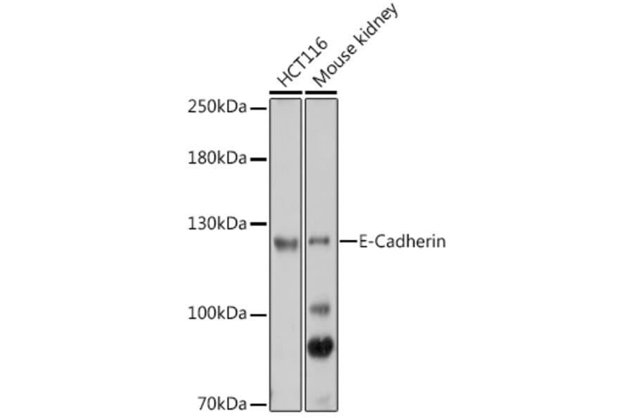 Western Blot - Anti-E Cadherin Antibody (A14318) - Antibodies.com