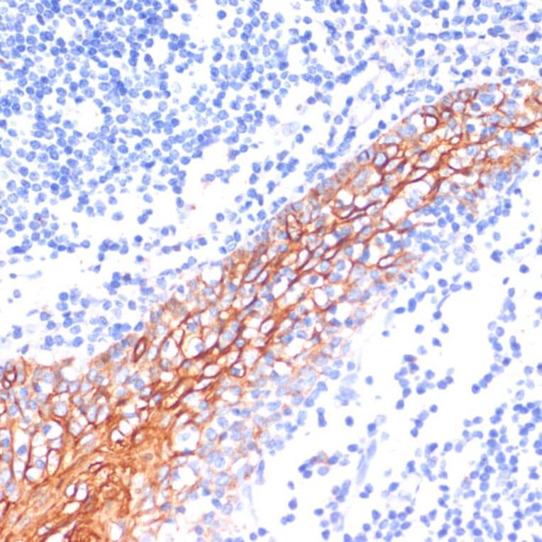 Immunohistochemistry - Anti-E Cadherin Antibody (A14318) - Antibodies.com