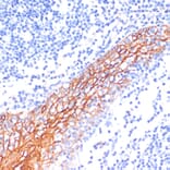 Immunohistochemistry - Anti-E Cadherin Antibody (A14318) - Antibodies.com