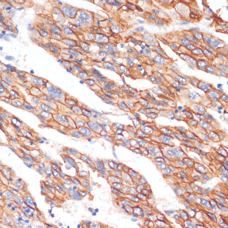 Immunohistochemistry - Anti-E Cadherin Antibody (A14318) - Antibodies.com