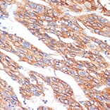 Immunohistochemistry - Anti-E Cadherin Antibody (A14318) - Antibodies.com